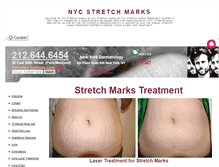 Tablet Screenshot of nycstretchmarks.org
